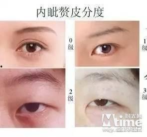 哪个明星是斜眼,揭秘明星的独特眼神魅力